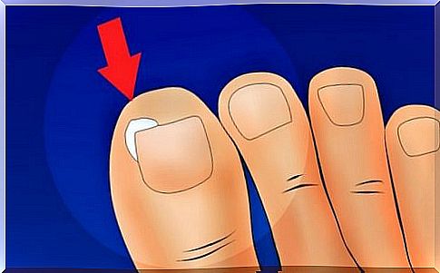 Treatment of ingrown toenails.