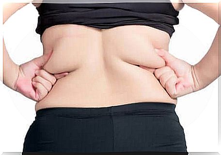 Accumulation of fat in a woman.