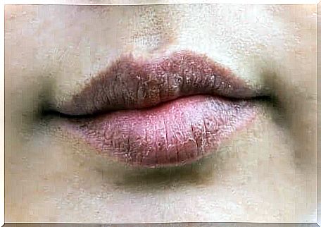 A woman's dry lips.