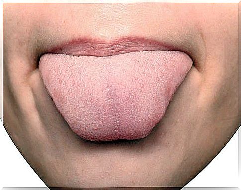 The color of the tongue is white indicates digestive problems